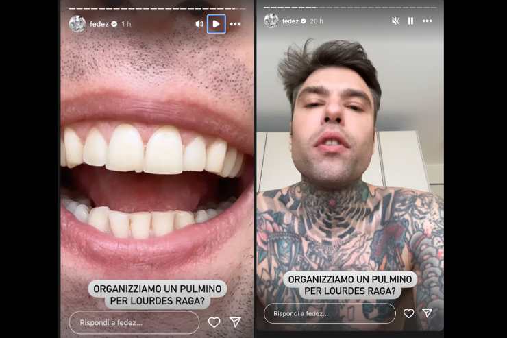 fedez