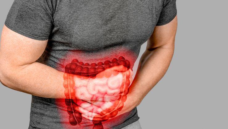 disbiosi intestinale può causare alitosi